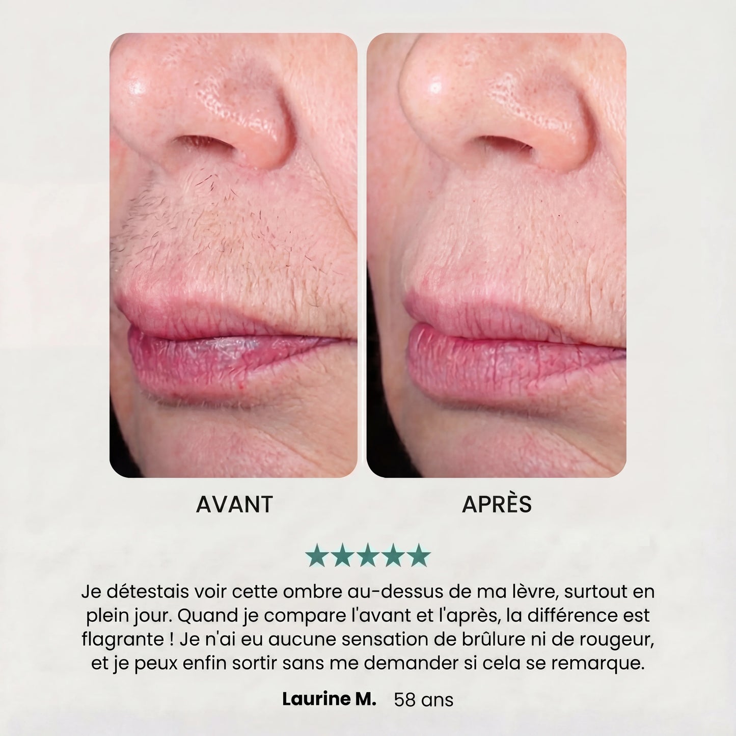 Soft Épilateur 2.0 Noreva
