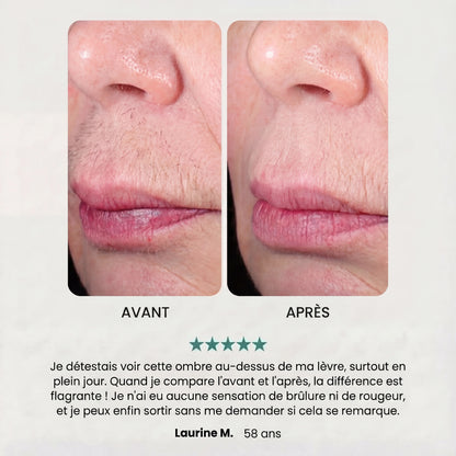 Soft Épilateur 2.0 Noreva