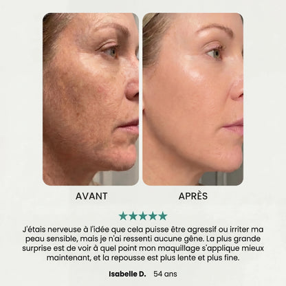 Soft Épilateur 2.0 Noreva