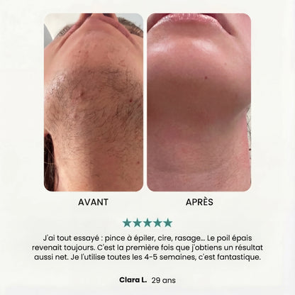 Soft Épilateur 2.0 Noreva